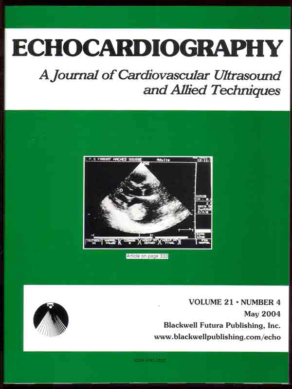 Зелена корица с надпис
            Echocardiography may 2004 BlackWell Futura Publishing
