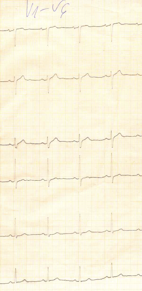 Изходна кардиограма